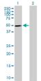 Zinc Finger Protein 383 antibody, H00163087-B01P, Novus Biologicals, Western Blot image 