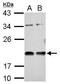Vasohibin 1 antibody, GTX115636, GeneTex, Western Blot image 