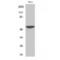 Serine/Threonine Kinase 33 antibody, LS-C386229, Lifespan Biosciences, Western Blot image 