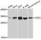 Uridine-Cytidine Kinase 2 antibody, A10815, ABclonal Technology, Western Blot image 