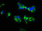 Laminin Subunit Gamma 1 antibody, LS-B13030, Lifespan Biosciences, Immunofluorescence image 