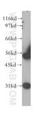 WT1 Transcription Factor antibody, 12609-1-AP, Proteintech Group, Western Blot image 