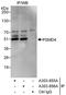 Proteasome 26S Subunit, Non-ATPase 4 antibody, A303-855A, Bethyl Labs, Immunoprecipitation image 