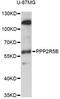 Protein Phosphatase 2 Regulatory Subunit B'Beta antibody, LS-C749255, Lifespan Biosciences, Western Blot image 