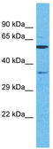 Olfactory Receptor Family 5 Subfamily C Member 1 antibody, TA337521, Origene, Western Blot image 