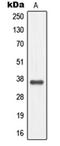 Melanocortin 4 Receptor antibody, orb214232, Biorbyt, Western Blot image 