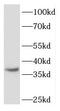 Fibroblast Growth Factor Binding Protein 2 antibody, FNab03097, FineTest, Western Blot image 