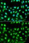 Survival of motor neuron protein-interacting protein 1 antibody, GTX33217, GeneTex, Immunocytochemistry image 