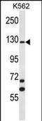 MCF.2 Cell Line Derived Transforming Sequence antibody, PA5-48397, Invitrogen Antibodies, Western Blot image 