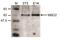 Methyl-CpG-binding domain protein 2 antibody, CI1099, Boster Biological Technology, Western Blot image 