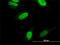 CaRF antibody, H00055602-M04, Novus Biologicals, Immunocytochemistry image 