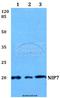 Nucleolar Pre-RRNA Processing Protein NIP7 antibody, A08120-1, Boster Biological Technology, Western Blot image 
