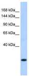 Protein SSX8 antibody, TA339918, Origene, Western Blot image 