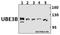 Ubiquitin Protein Ligase E3B antibody, GTX66821, GeneTex, Western Blot image 