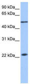 Protein Inhibitor Of Activated STAT 2 antibody, TA335365, Origene, Western Blot image 