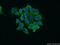 Ribosomal Protein S25 antibody, 23599-1-AP, Proteintech Group, Immunofluorescence image 