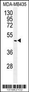 Growth Differentiation Factor 5 antibody, 56-193, ProSci, Western Blot image 