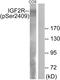Insulin Like Growth Factor 2 Receptor antibody, AP55736PU-S, Origene, Western Blot image 