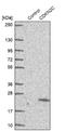 Cyclin Dependent Kinase Inhibitor 2C antibody, NBP1-87687, Novus Biologicals, Western Blot image 