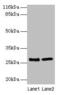 EBP Cholestenol Delta-Isomerase antibody, CSB-PA624016EA01HU, Cusabio, Western Blot image 
