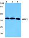 Single Stranded DNA Binding Protein 2 antibody, A09631, Boster Biological Technology, Western Blot image 