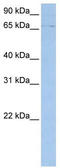 ATP Binding Cassette Subfamily F Member 3 antibody, TA331865, Origene, Western Blot image 