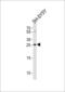 Probable palmitoyltransferase ZDHHC21 antibody, MBS9204336, MyBioSource, Western Blot image 