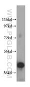 Ribosome Biogenesis Regulator 1 Homolog antibody, 15329-1-AP, Proteintech Group, Western Blot image 