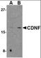 Cerebral Dopamine Neurotrophic Factor antibody, orb88414, Biorbyt, Western Blot image 