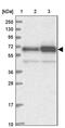 Arginyltransferase 1 antibody, PA5-58391, Invitrogen Antibodies, Western Blot image 