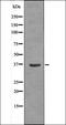 cAMP-dependent protein kinase catalytic subunit alpha antibody, orb335685, Biorbyt, Western Blot image 