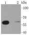 Glutaminase antibody, A01272-1, Boster Biological Technology, Western Blot image 