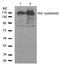 Insulin Receptor Substrate 1 antibody, AP02489PU-S, Origene, Western Blot image 