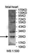 F-Box Protein 44 antibody, orb78440, Biorbyt, Western Blot image 