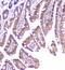 D-Dopachrome Tautomerase antibody, A01354, Boster Biological Technology, Immunohistochemistry paraffin image 