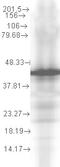 DnaJ Heat Shock Protein Family (Hsp40) Member A2 antibody, TA309370, Origene, Western Blot image 