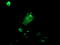 Signal Sequence Receptor Subunit 1 antibody, TA503266, Origene, Immunofluorescence image 
