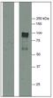 Fibrinogen alpha chain antibody, AM31995PU-N, Origene, Western Blot image 