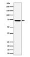 BLNK antibody, M03630-2, Boster Biological Technology, Western Blot image 