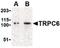 Short transient receptor potential channel 6 antibody, PA5-20257, Invitrogen Antibodies, Western Blot image 