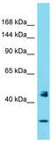 Period circadian protein homolog 1 antibody, TA344556, Origene, Western Blot image 