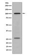 Premelanosome Protein antibody, M01262, Boster Biological Technology, Western Blot image 