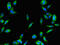 SUMO Specific Peptidase 1 antibody, CSB-PA885787LA01HU, Cusabio, Immunofluorescence image 