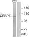 CCAAT/enhancer-binding protein zeta antibody, LS-C118985, Lifespan Biosciences, Western Blot image 