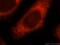 Lysophosphatidylcholine Acyltransferase 1 antibody, 16112-1-AP, Proteintech Group, Immunofluorescence image 