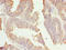 Retention In Endoplasmic Reticulum Sorting Receptor 1 antibody, LS-C376457, Lifespan Biosciences, Immunohistochemistry paraffin image 