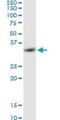Pyrroline-5-Carboxylate Reductase 2 antibody, H00029920-D01P, Novus Biologicals, Western Blot image 