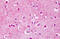 Protein Tyrosine Phosphatase Receptor Type A antibody, MBS247773, MyBioSource, Immunohistochemistry frozen image 