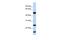Ubiquitin Conjugating Enzyme E2 L6 antibody, PA5-42284, Invitrogen Antibodies, Western Blot image 