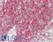 Bruton Tyrosine Kinase antibody, LS-B14229, Lifespan Biosciences, Immunohistochemistry paraffin image 
